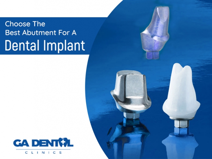 implants abutment